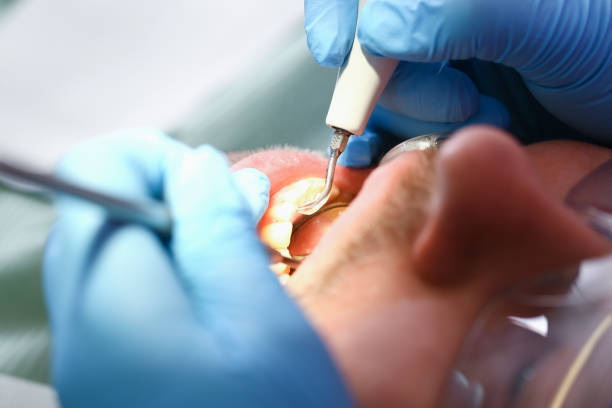 Best Orthodontic Emergency Dentist in Amador Pines, CA
