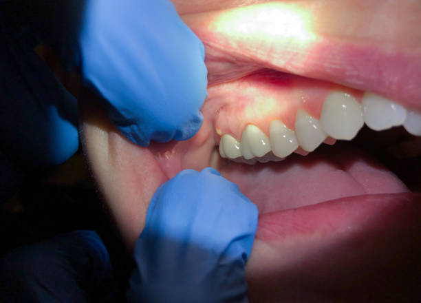 Best Pediatric Emergency Dentist in Amador Pines, CA