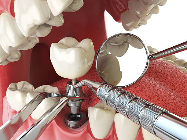 Best Pediatric Emergency Dentist in Amador Pines, CA